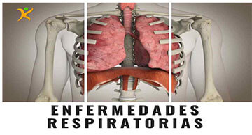 Enfermedades Respiratorias